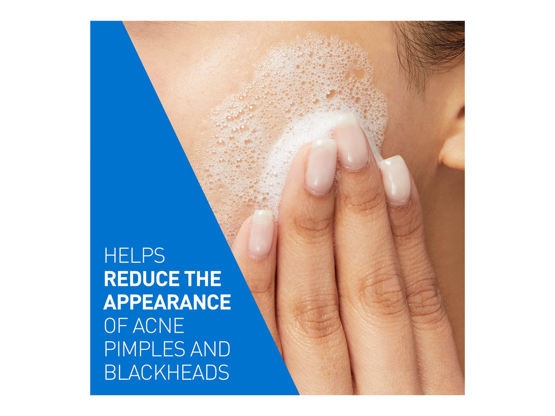 Cerave Acne Control Cleanser in Sri Lanka