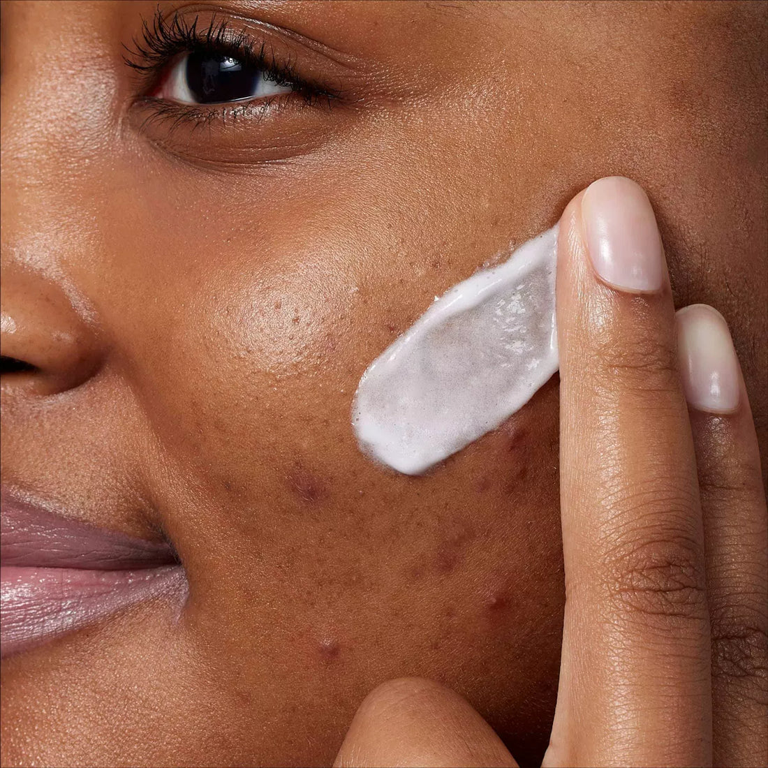 CeraVe Acne Foaming Cream Cleanser with 10% benzoyl peroxide in Sri Lanka 150ml
