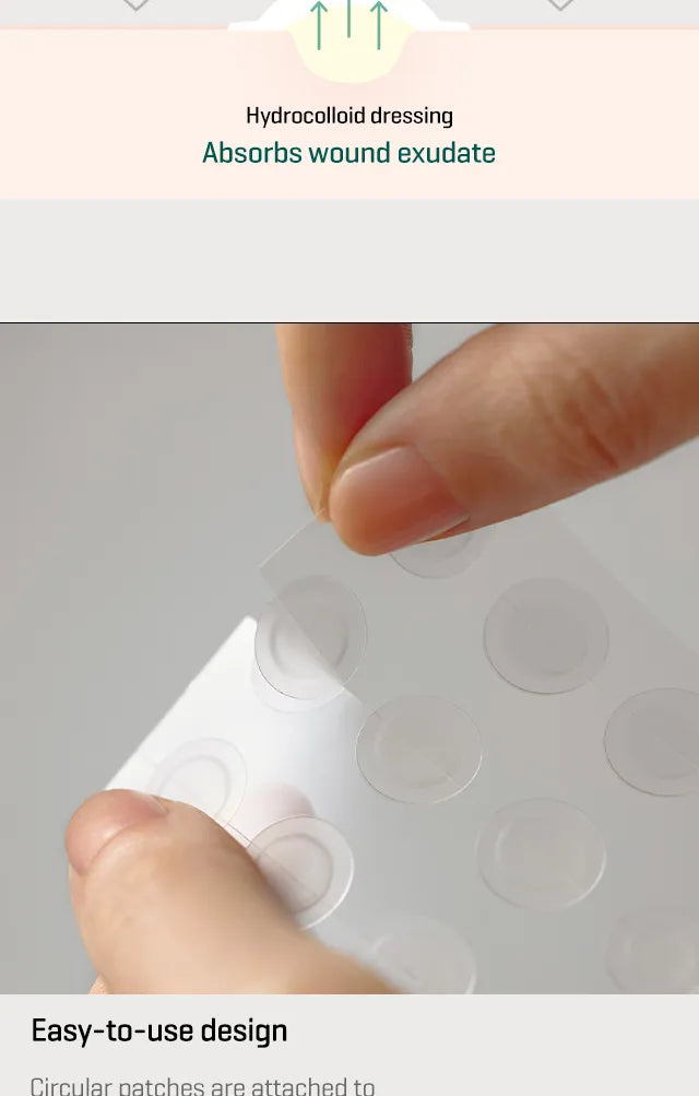 SOME BY MI - 30 Days Miracle Clear Spot Patch