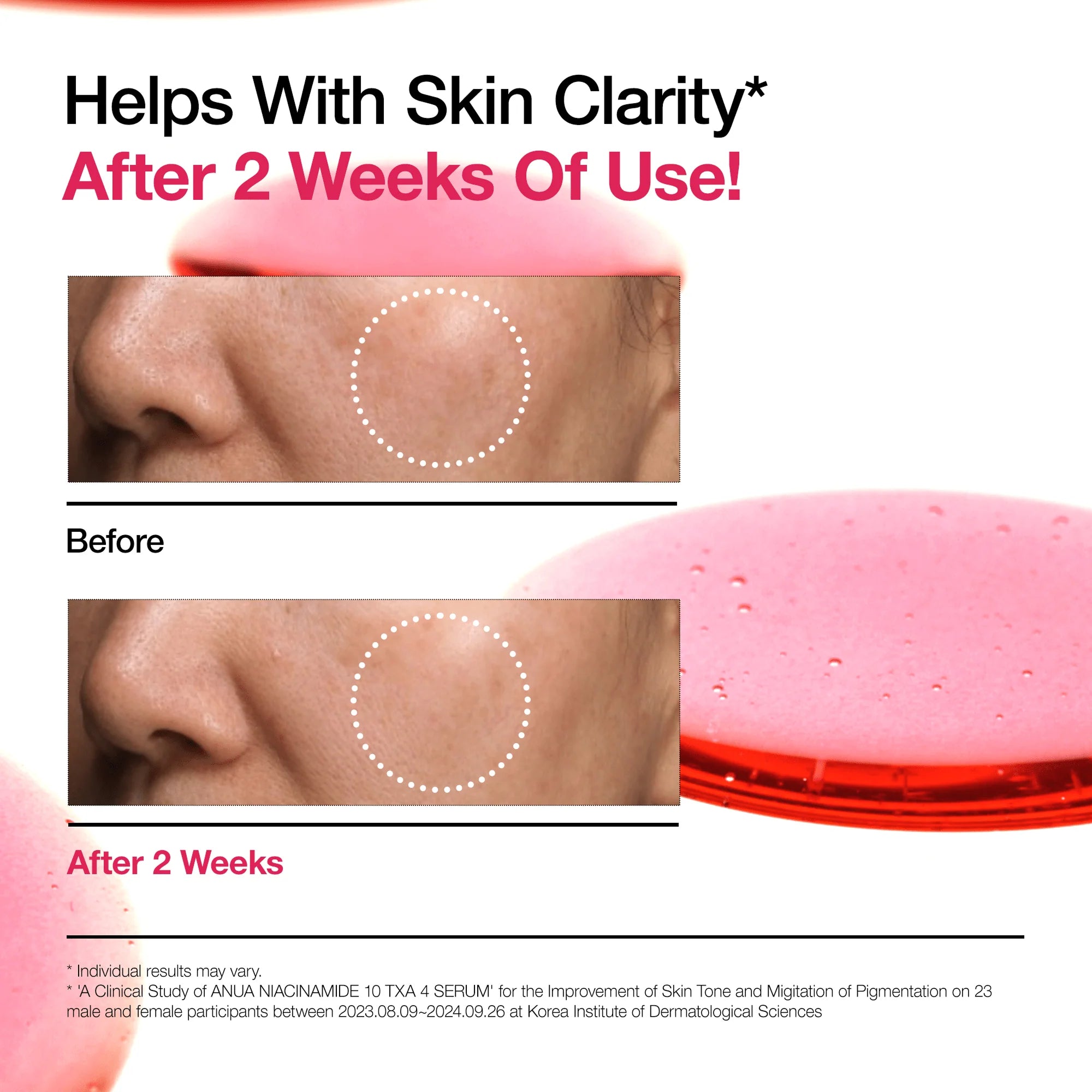 Anua Niacinamide 10% +TXA 4% Dark Spot Correcting Serum 30ml in Sri Lanka