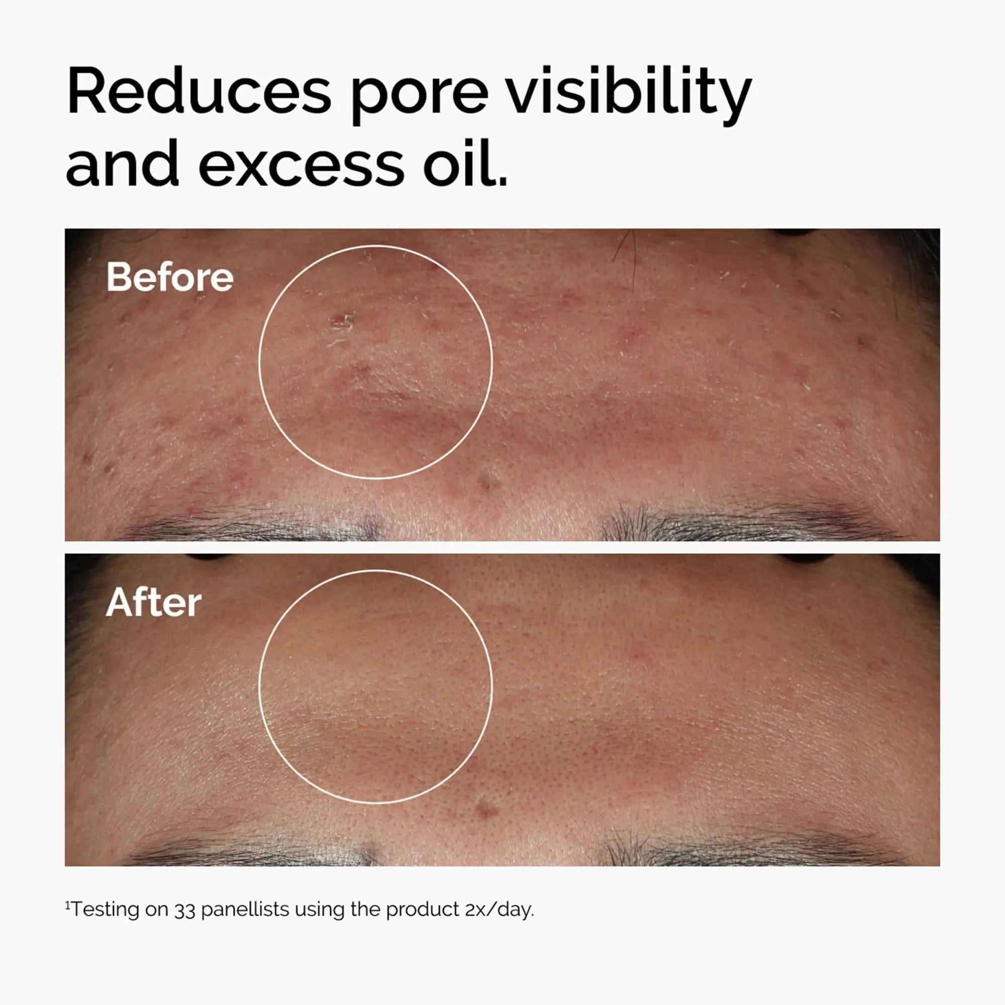 The Ordinary Niacinamide 10% + Zinc 1% in Sri Lanka