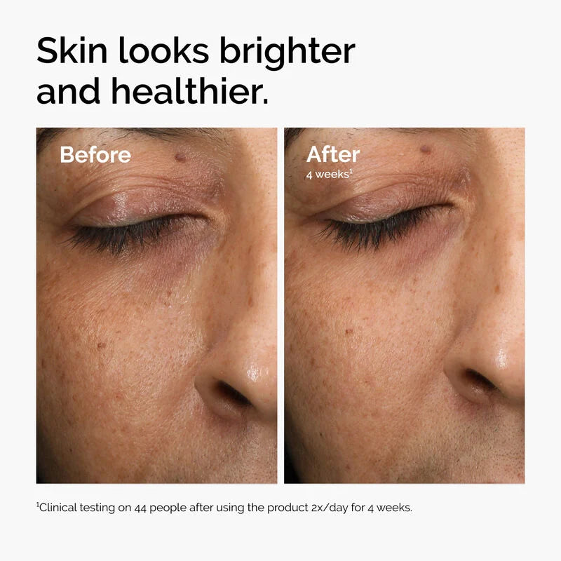 Multi-Antioxidant Radiance Serum 30ml